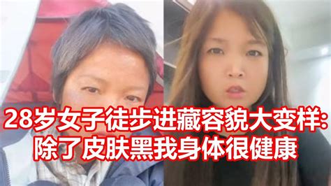 28岁女子徒步进藏容貌大变样 除了皮肤黑我身体很健康 Youtube