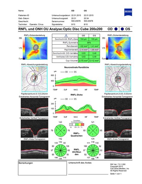 Optische Koh Renztomographie Oct Augenarzt Privatpraxis Hamburg