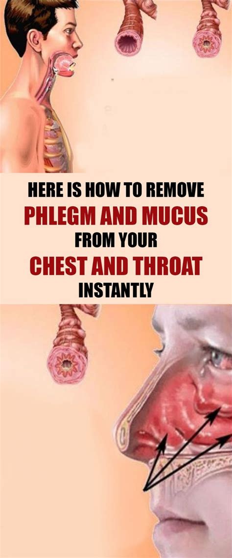 Here Is How To Remove Phlegm And Mucus From Your Chest And Throat