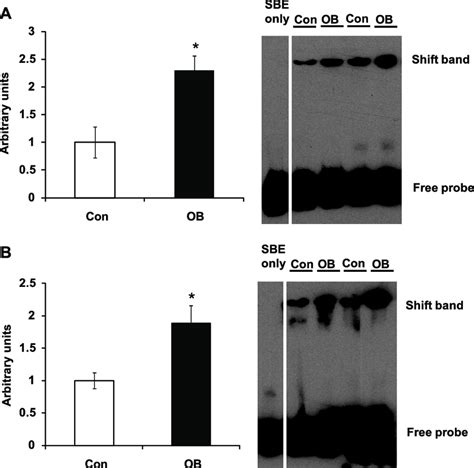 Electrophoretic Mobility Shift Assay Emsa Of Nucleoproteins Extracted