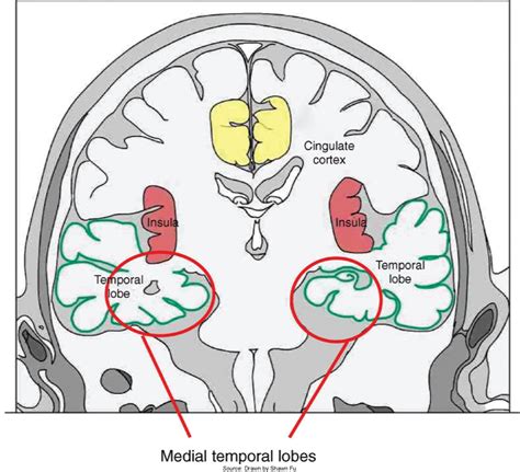 Temporal LOBE at emaze Presentation