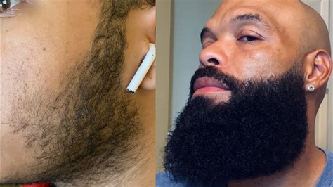 Beard Journey Tips Dealing With The Uncomfortable Beard Stage My