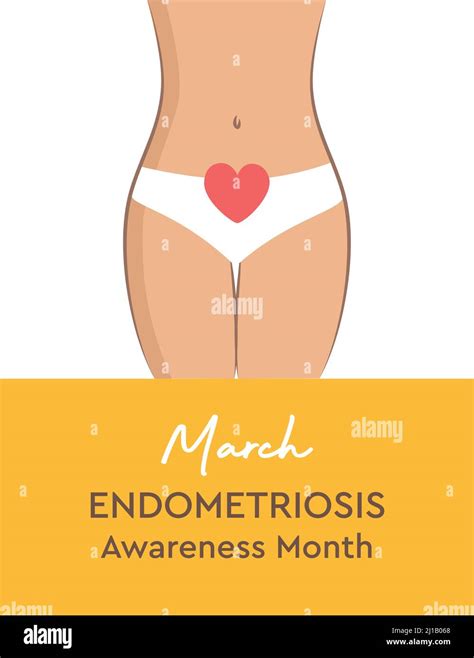 National Endometriosis Awareness Month March Info Graphic Stock Vector Image And Art Alamy