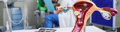 O Que É Colpocitologia Oncótica - O que é a colpocitologia oncótica e para que serve?