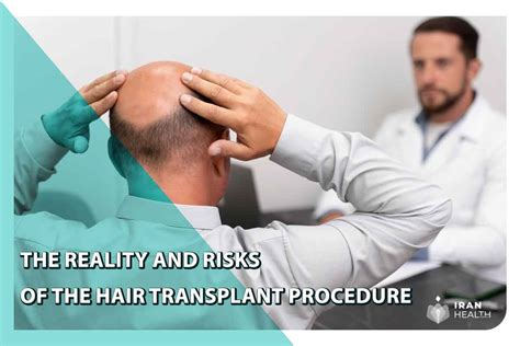 The Reality And Risks Of The Hair Transplant Procedure[ Checklist For A Hair Transplant