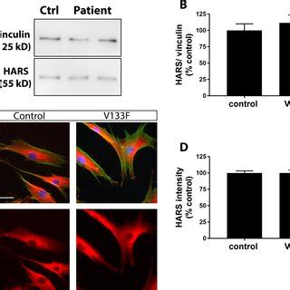 AD HARS Western Blotting And Immunofluorescence Microscopy In