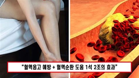 매일 부어있는 종아리에 직빵 막혀있던 혈관을 뻥 뚫어 혈액순환 노폐물 배출 붓기 완화 시켜주는 음식 육아홀릭