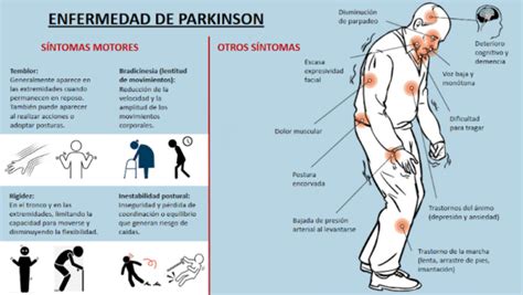 Enfermedad De Parkinson Clínica Josefina Arregui