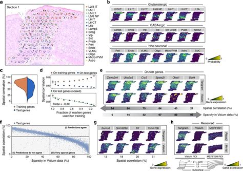 Lower Resolution Spatial Transcriptomics Visium Spatial