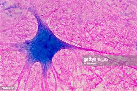 Neurons Microscope Foto E Immagini Stock Getty Images