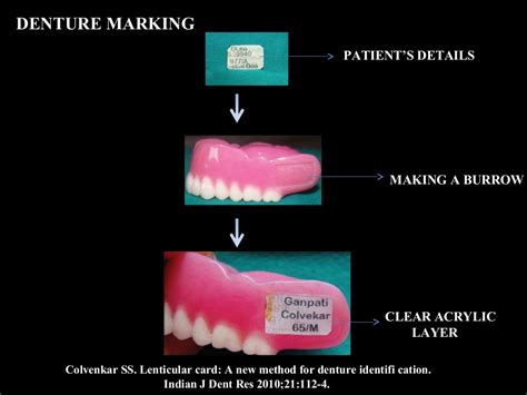 Forensic odontology