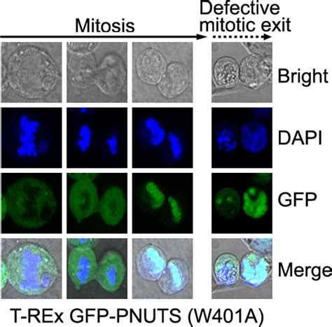 Dysregulation Of The PTW PP1 Phosphatase Complex Causes Defects At