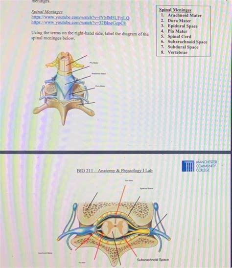 Solved Spinal Cord | Chegg.com 