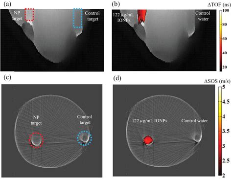 Breast Phantom Imaging A Baseline Tof Projection Image The Left Download Scientific Diagram