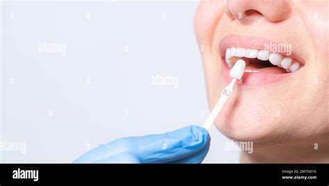 Banner Tooth Whitening Perfect White Teeth Close Up With Shade Guide