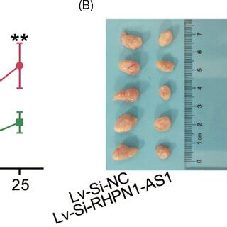 RHPN1AS1 Enhanced Cisplatin Resistance In Vitro A CCK8 Assay Proved