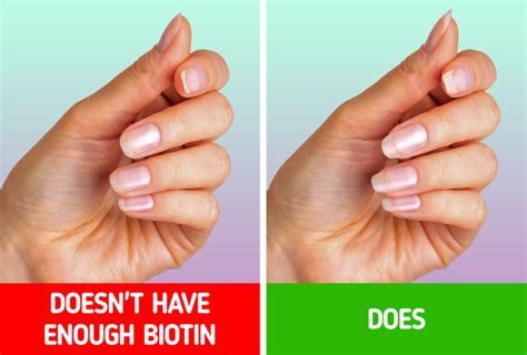 7 Useful Tips For How To Grow Your Nails Faster And Healthier 5