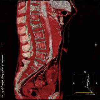 Técnicas Radiológicas y Avances TC ABDOMINAL