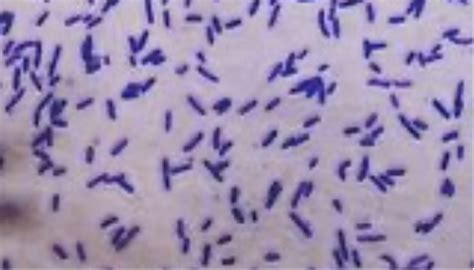 Lab 2 Gram Staining Flashcards Quizlet