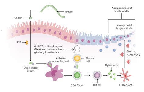 Celiac Disease Concise Medical Knowledge