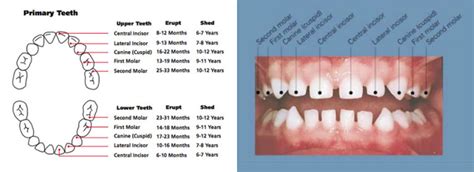 Tooth Eruption In Primary Teeth Dr Dunne Eugene Dentist Pediatric Dentistry Emergency