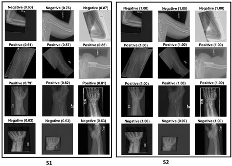 Cancers Free Full Text Deep Transfer Learning With Enhanced Feature