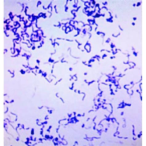 Pdf Aortic Valve Endocarditis With Erysipelothrix Rhusiopathiae A