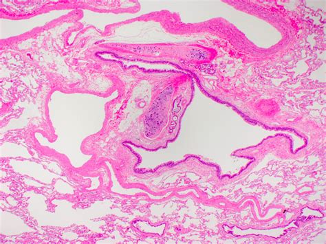 Pathology Outlines Histology