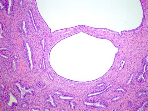 Histología Del Endocérvix