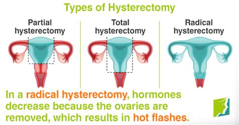 Hot Flashes After A Hysterectomy Menopause Now