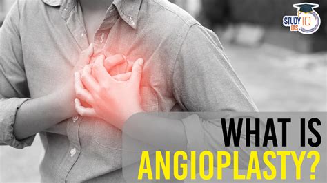 Angioplasty Types Procedure Risks And Recovery