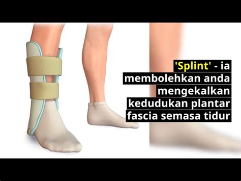 Punca Sakit Tumit Kaki Bagi Wanita Punca Puncak