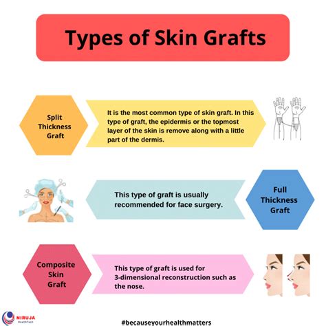 Types Of Skin Grafts Skin Grafting Grafting Reconstructive Surgery