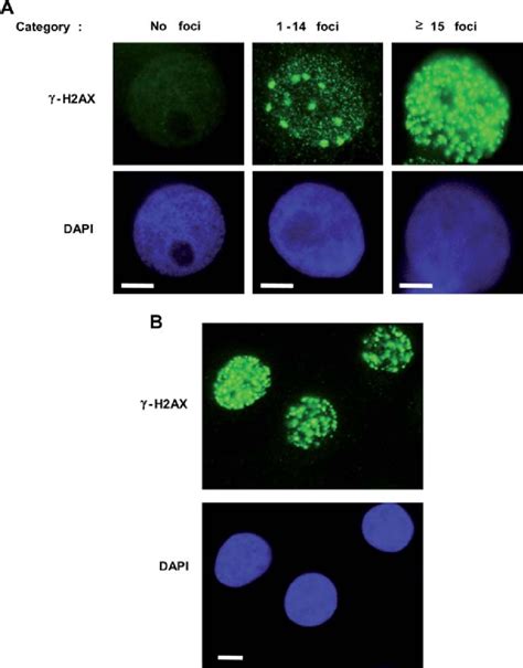 Representative Patterns Of γ H2ax Foci Per Nucleus In Mammary