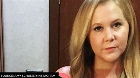 Amy Schumer Diagnosed With Lyme Disease Says Excited To Get Rid Of It