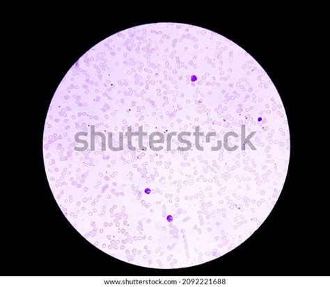 Dimorphic rbc : 8 images, photos et images vectorielles de stock ...
