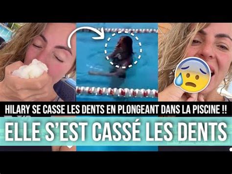 Hillary Se Casse Les Dents De Devant En Sautant Dans La Piscine Les