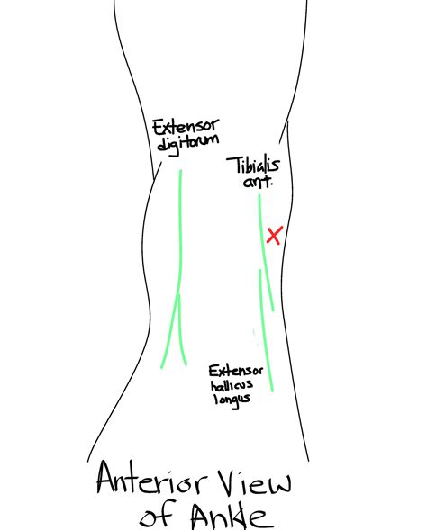 Ultrasound Guided Ankle Arthrocentesis | Resus Review