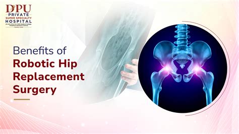 Benefits Of Robotic Hip Replacement Surgery DPU Hospital