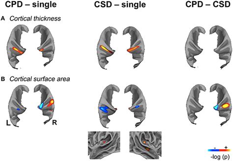 Frontiers Surface Based Morphometry Of Cortical Thickness And Surface