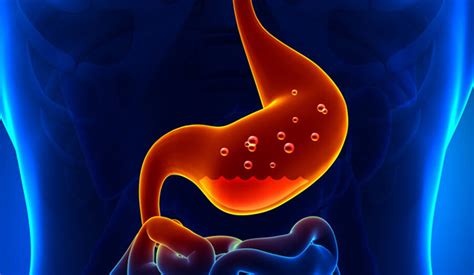 Гастрит с пониженной кислотностью — surgery-first.ru