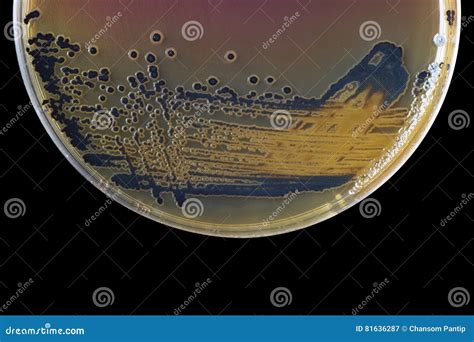 Black Bacterial Colonies Of Salmonella Species On Salmonella Shigella