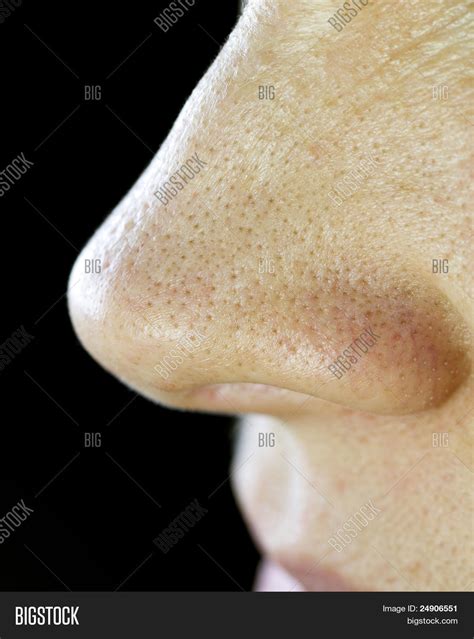 Nose Pores Blackheads Image & Photo | Bigstock