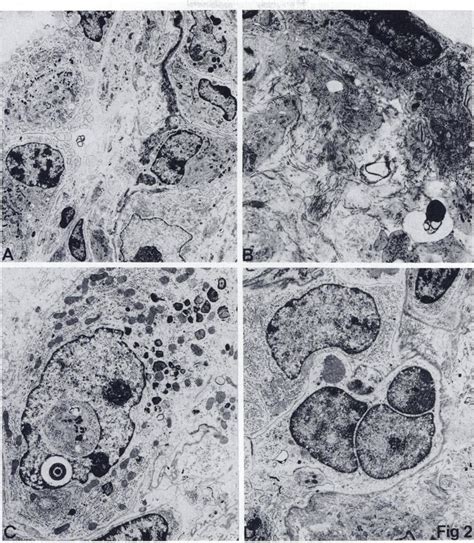 Fig2 Fig 2 In A Type II Pneumocytes Constitute The Main Cell Type