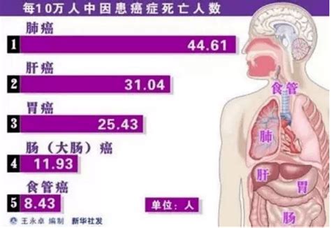 五种人容易得癌症，太可怕了，赶紧分享出去 研究