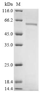 Recombinant Human Cytochrome P450 1A1 CYP1A1