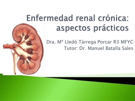 Ppt Enfermedad Renal Cr Nica Aspectos Pr Cticos Powerpoint