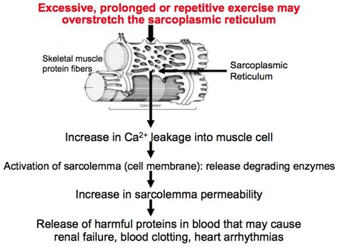 Exertional Rhabdomyolysis Mechanism