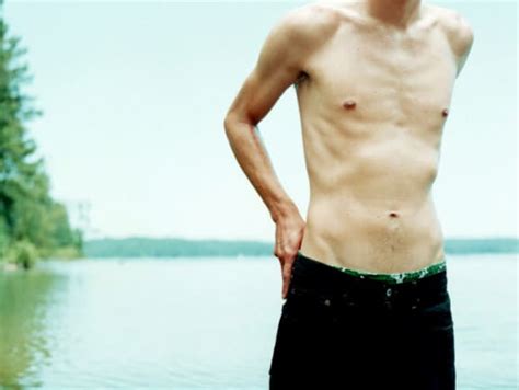 Male Anorexia On The Rise