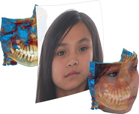 dolphin  imaging software dolphin imaging software